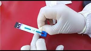 Diagnóstico de VIH: operativo sanitario provincial Diagnóstico de VIH: operativo sanitario provincial